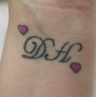 gallery/sarah before laser